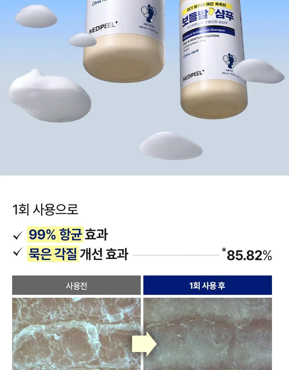 [베스트템] 메디필 EGF 스케일링 모이스처 버블 풋 샴푸 400ml 상세페이지 11